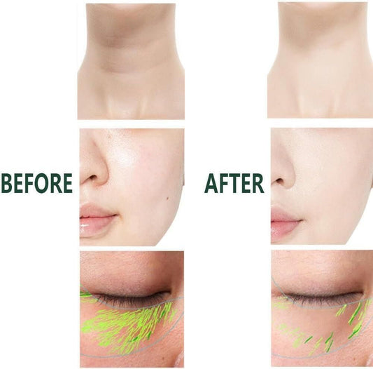 Facial Massager For Eye, Neck and Face